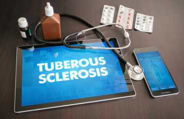 Туберозный склероз как причина нейропсихических расстройств