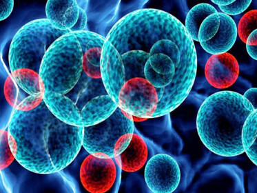 FDA одобрило препарат для лечения рефрактерной или рецидивирующей диффузной В‑крупноклеточной лимфомы
