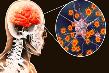 Фактори ризику розвитку менінгококової інфекції у дітей і дорослих: результати систематичного огляду і метааналізу