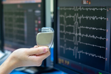 Аспекти кардіостимуляції та кардіоресинхронізувальної терапії: новації 2021 року