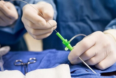 Тромболітична терапія при ішемічному інсульті: вплив різних факторів на ефективність та несприятливі результати