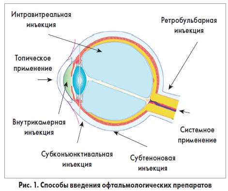 коллоидные системы доставки лекарств в офтальмологической практике включают в себя микросомы. Смотреть фото коллоидные системы доставки лекарств в офтальмологической практике включают в себя микросомы. Смотреть картинку коллоидные системы доставки лекарств в офтальмологической практике включают в себя микросомы. Картинка про коллоидные системы доставки лекарств в офтальмологической практике включают в себя микросомы. Фото коллоидные системы доставки лекарств в офтальмологической практике включают в себя микросомы коллоидные системы доставки лекарств в офтальмологической практике включают в себя микросомы. Смотреть фото коллоидные системы доставки лекарств в офтальмологической практике включают в себя микросомы. Смотреть картинку коллоидные системы доставки лекарств в офтальмологической практике включают в себя микросомы. Картинка про коллоидные системы доставки лекарств в офтальмологической практике включают в себя микросомы. Фото коллоидные системы доставки лекарств в офтальмологической практике включают в себя микросомы