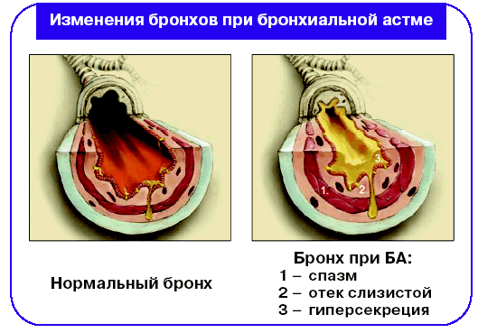 http://www.health-ua.com/pics/tabl/163_14.gif
