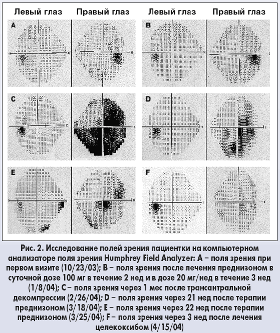 Преднизон фото