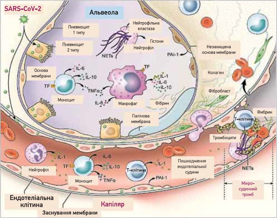 Рис. 3. Механізми коагулопатії й імунної активації при COVID‑19